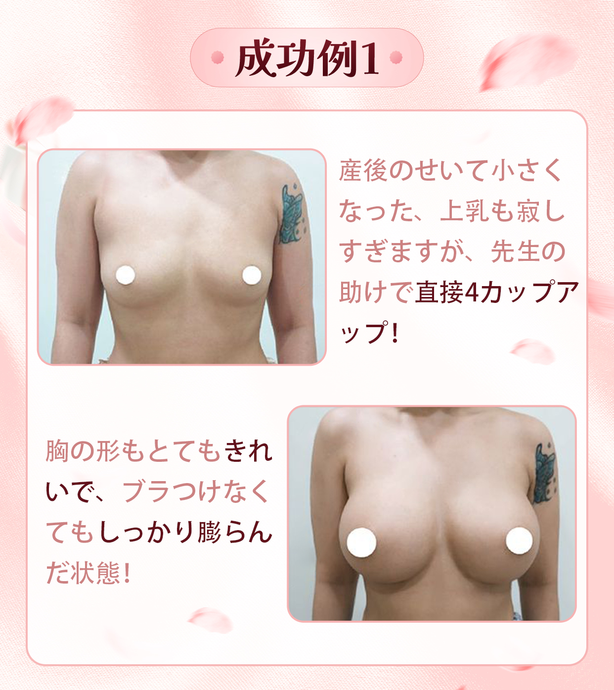 成功例1